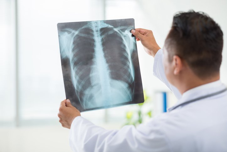 X-Ray